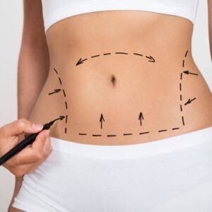 A woman is drawing lines on her stomach.