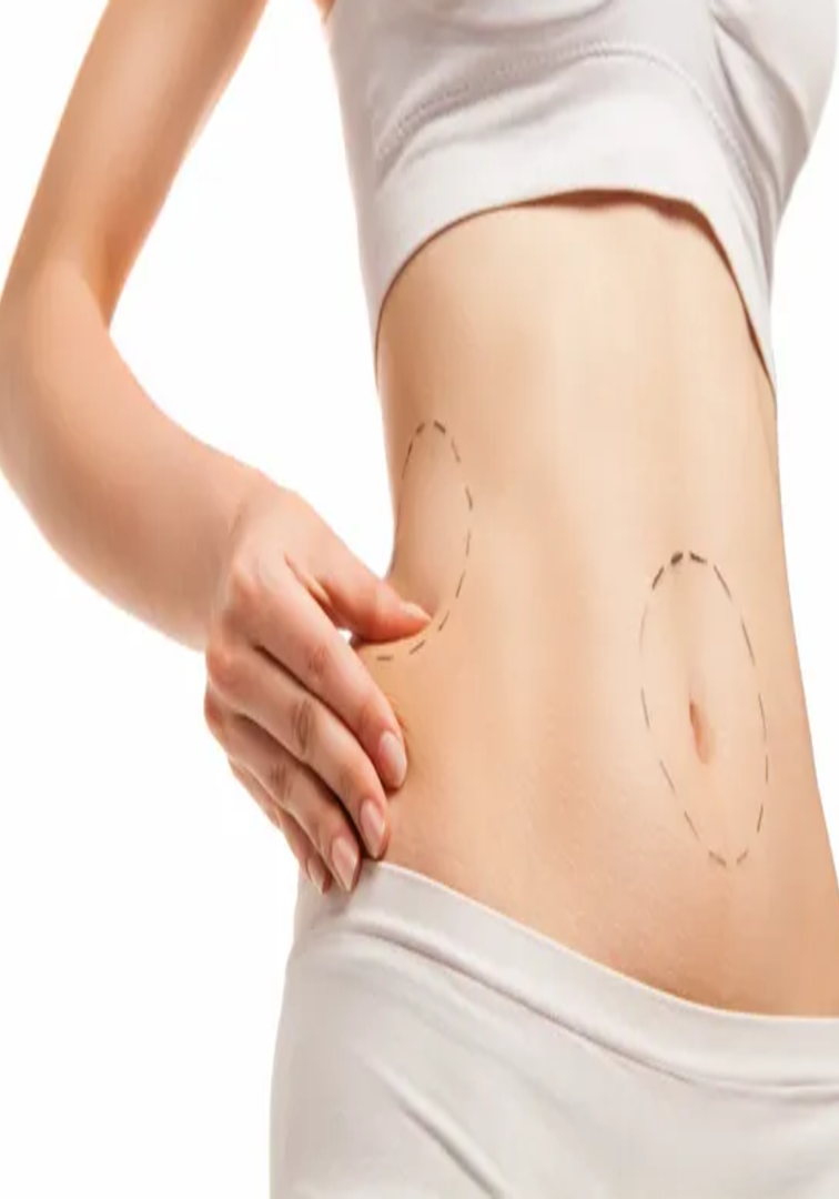 A woman is holding her stomach with marks on it.